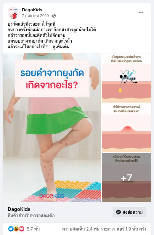 รอยดำจากยุงกัด เกิดจากอะไร