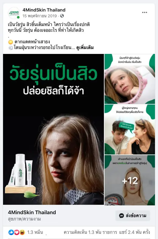 วัยรุ่นเป็นสิว ปล่อยชิลก็ได้จ้า